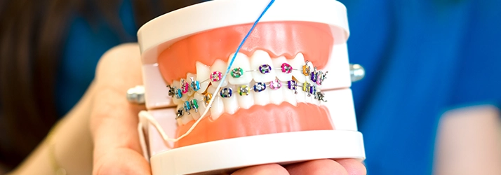 Orthodontic Services in Monsey NY