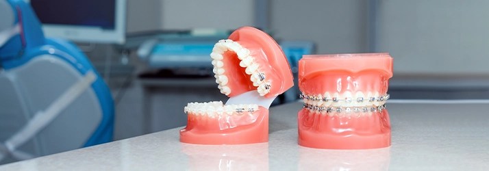 Metal Braces in Monsey NY Metal Braces in Monsey NY
