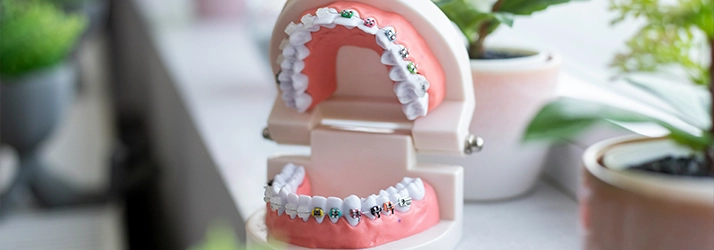 FC – Regular Braces At Wesley Hills Orthodontics in Monsey, NY